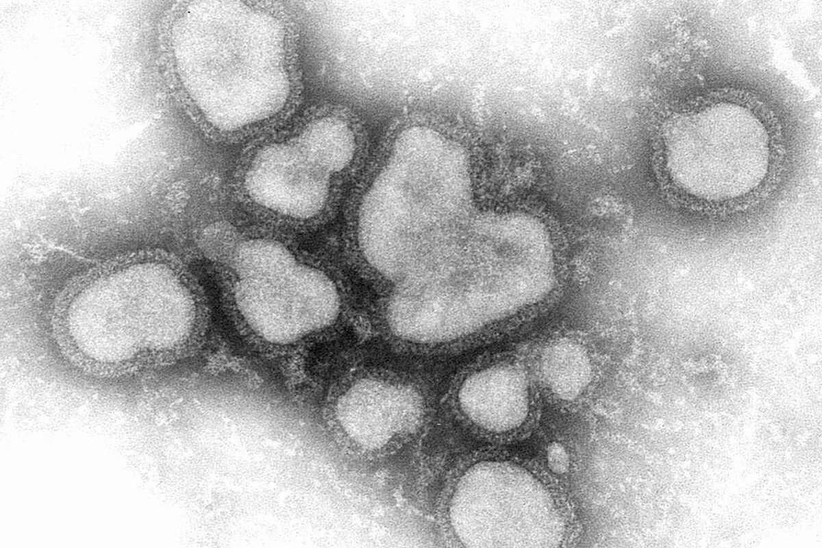 Mikrograf elektron arsip tahun 1976 yang memperlihatkan partikel virus influenza A.